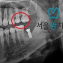 서울완치과 이미지