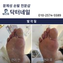 청주 동남지구 오창 진천 굳은살 발각질 제거 발에 수분기까지 완벽하게 관리해드립니다😛 이미지