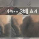 천안눈썹왁싱두피탈모뷰티플로에모리바이브 | 천안 두정동 ) 탈모가 고민이라면 , 모발생장술 모리바이브 !