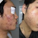 케이엠종합건설 | 마곡 피부관리, 화장품이 겉돈다면? 니코티노이드로 세포 배터리부터 충전하기