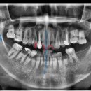 의정부본플란트치과의원 이미지