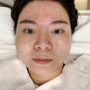 미소지앤의원 | 과천 피부관리 웨딩케어 과천예일의원 미소지앤 캐비어 재생 관리 후기