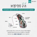 하단독일보청기 이미지