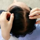 더헤어라인성형외과의원 이미지