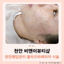 천안웨딩관리 플라즈마레이저 잡티제거 비앤이뷰티샵 추천