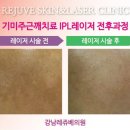 강남레쥬베의원 이미지