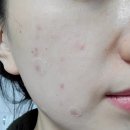 바이어간츠코리아 | 바이어간츠 비타민A 레티날크림 잔주름 피부결 사용후기