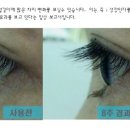 MGF두피탈모센타