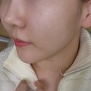 CNP차앤박피부과의원 이미지