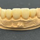 심미치과기공소 이미지