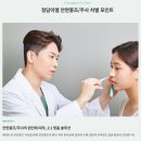 청담이엘의원 | 브이빔 레이저 효과 ‘의사가 직접’ 제대로 알려드립니다