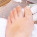 청주 문제성 발, 아치 지지 인솔(깔창)제작 후기 엘엔제이 왁싱 레푸스 오창점
