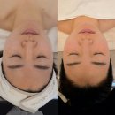 남구-124 | 울산 남구 피부관리 스킨뮤제｜속건조·처짐 고민 솔직 후기