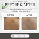 아이비에스테틱 이미지