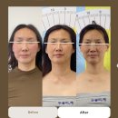 당당한 체형 연구소 | 갱년기 체형변화 – 갈마동 라움리포벨 갱년기여성관리 후기