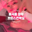봉곡동199 | 봉곡동 피부 관리 잘하는 쁘띠스킨왁싱 물방울관리와 하이푸 리프팅 솔직후기