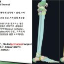 [11강-발목/발-3](82강)골학(osteology),발목뼈,발허리뼈,발가락뼈,돌림축, 엎침,뒤침,mortise,tenon 이미지