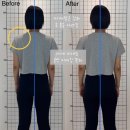 (주)성화메디칼 | 부평 필라테스 목 어깨 통증 한방에 해결한 실제후기