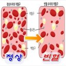 당뇨병 정상 혈당 수치 종류 원인 증상 진단 검사 치료 예방 합병증 2형 당뇨 혈당 측정 방법 이미지