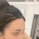 미로헤어라인