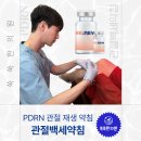 별내우리한의원 | 무릎 어깨 손목 관절통증, 관절백세약침으로 잡자! PDRN 재생약침치료 - 별내한의원