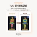 바이오포톤테라피 이미지