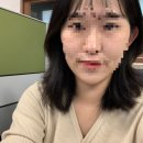 원주가구랜드 | 갑상선항진증(그레이브스병)으로 인한 전절제술 후기