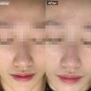 [남양 피부샵] 피부관리는 샤론뷰티에스테틱 화성점 / 파메스테틱 제품 관리 후기