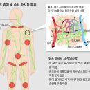 ◇림프 마사지, 해도 될 때 vs 하면 안 될 때 이미지