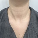 청담초등학교 | 청담동 피부과 연예인 목주름필러 벨로테로 날짜별 후기