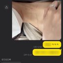 노삼웅한의원 네이버블로그
