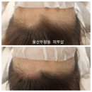 수정헤어 이미지