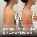 S라인에스테틱 | W.25. 수원 광교 신부관리 지수에스테틱 | 웨딩 드레스라인 관리 후기