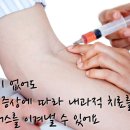 소참 이미지