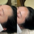 아이리헤어 - 92342 | 수완지구헤어라인 관리잘하는 곳 아이리부티크 후기
