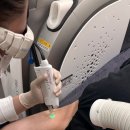 화이트피부과의원 | [강남 피부과] 겨드랑이 레이저 제모 + 화이트 토닝 리얼 후기