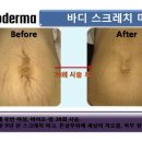 제이스킨 앤 바디 이미지