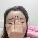 귀필러 하나로 얼굴 작아보이는 이유? 누운귀·작은귀 요정귀 변화 내돈내산 후기 (강남역 성형외과)
