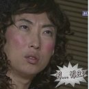 [시험관 1차 7편] 장기요법 후 난자채취 당일의 기록