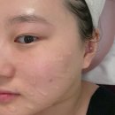 강원도교육연구원 | 강원도 춘천피부관리 글루타치온 화이트토닝 춘천 뷰티오로라엘 본점에서 처음 관리받은 후기