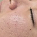 더예쁜날 | 낙성대피부관리 잘하는 곳 더예쁜날 MTS 후기