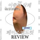 보정없이 셀피 찍는 방법 내돈내산 압구정피부과 이중턱 페이스엔드컷 후기
