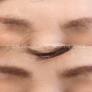 라이모플러스(LYMOPLUS) 이미지