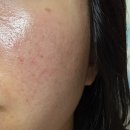 바이오프로젝트 | 🧴윤은혜 수분크림, 내추럴더마 프로젝트 시카 바이오 플라센타 크림 속건조 추천 🧴내돈내산 후기