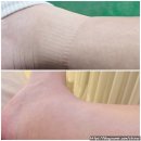 영PC | 동두천 산전마사지 지행동 더영뷰티 임산부 출산 전 붓기관리 후기