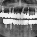 하앤박치과의원 이미지