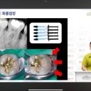 조성근치과의원 네이버블로그