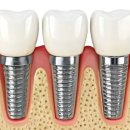 서울라파치과의원 이미지