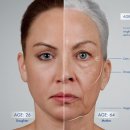 리셋의원 이미지