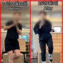 운동과학연구센터(대전) | 대전 PT &lt;발목 통증&gt; 극복 후기, 밸런스와 고관절
